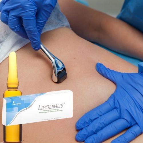Lipolimus By Denova - Solución Extracto de Alcachofa - Adelgazante y Anticelulítico - 10Amp x 2ml