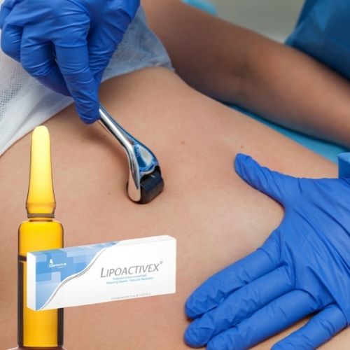 Mano de profesional de la estética haciendo tratamiento con un aparato.