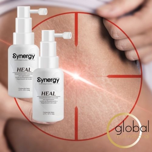 Mujer mostrando con sus mano las estrías en su cadera. Loción Synergy Heal para el cuidado de la piel.