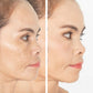 Face with melasma and brown spots before and after facial serum