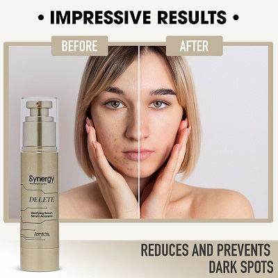 Synergy Delete Serum Aclarante Antimanchas Faciales 1.7FL Oz
